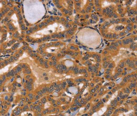 Anti-Human CCL23 Antibody