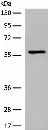 Western blot analysis of Jurkat cell lysate using M1AP Polyclonal Antibody at dilution of 1:600