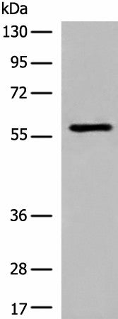 Western blot analysis of Jurkat cell lysate using M1AP Polyclonal Antibody at dilution of 1:600