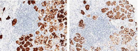 Anti-Human PGC Antibody [A972] - ABMIUM