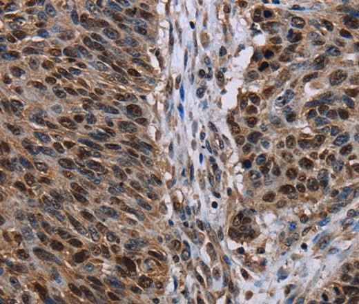 Anti-Human/Mouse KDM3B Antibody