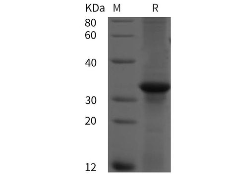 SDS-PAGE analysis of Human RAB5A proteins, 2 μg/lane of Recombinant Human RAB5A proteins was resolved with SDS-PAGE under reducing conditions, showing bands at 32 kDa.