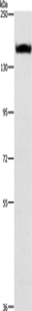 Anti-Human ITGA2 Antibody - ABMIUM
