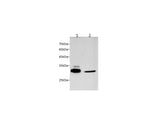 Anti-Human/Mouse/Rat MYD88 Antibody - ABMIUM