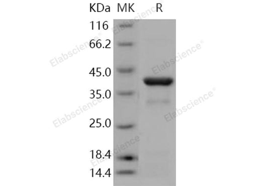 Recombinant Human IKB alpha/NFKBIA Protein (His Tag) - ABMIUM