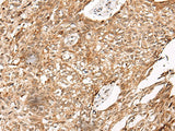 Anti-Human/Mouse/Rat C14orf169 Antibody - ABMIUM