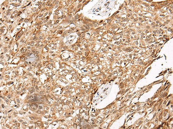 Anti-Human/Mouse/Rat C14orf169 Antibody - ABMIUM