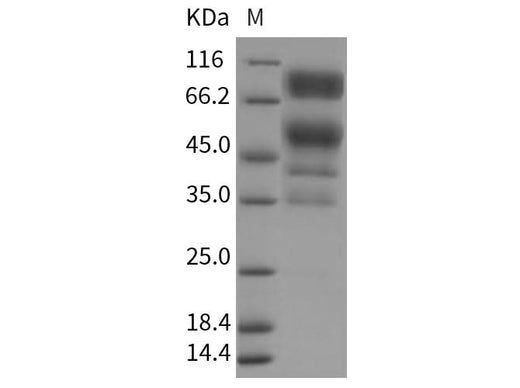 > 82 % as determined by reducing SDS-PAGE.