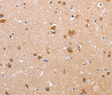 Anti-Human CLDN10 Antibody - ABMIUM
