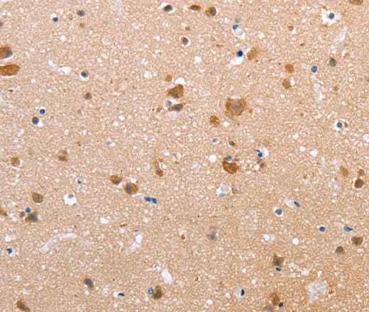 Anti-Human CLDN10 Antibody