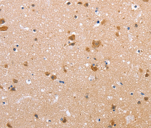 Anti-Human CLDN10 Antibody - ABMIUM