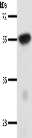 Anti-Human/Mouse/Rat SLC32A1 Antibody - ABMIUM