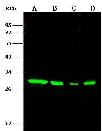 Anti-Human NQO1 Antibody [A1272] - ABMIUM