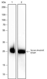 Anti-Human Serum Amyloid P/SAP Antibody [A358]