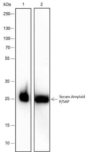 Anti-Human Serum Amyloid P/SAP Antibody [A358] - ABMIUM