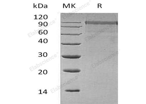 Recombinant Human MASP1 Protein (His Tag) - ABMIUM
