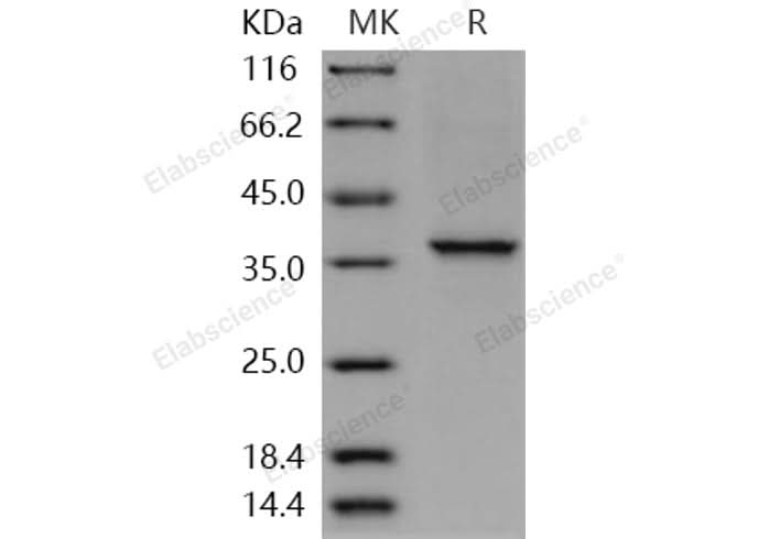 > 92 % as determined by reducing SDS-PAGE.