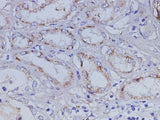 Anti-Human IGFBP7 Antibody - ABMIUM