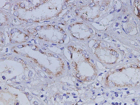 Anti-Human IGFBP7 Antibody