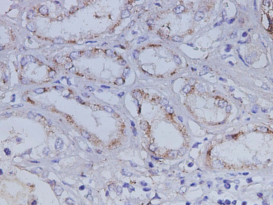 Anti-Human IGFBP7 Antibody - ABMIUM