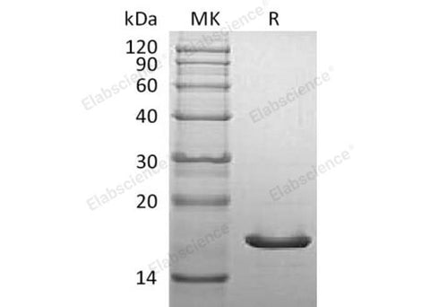 Recombinant Mouse α-Synuclein/SNCA Protein - ABMIUM