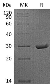Recombinant Mouse APCS/SAP Protein (His Tag) - ABMIUM