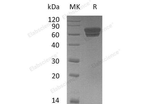 Recombinant Mouse EDAR/DL Protein (Fc Tag) - ABMIUM