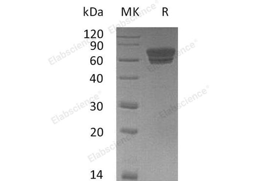 Recombinant Mouse EDAR/DL Protein (Fc Tag) - ABMIUM
