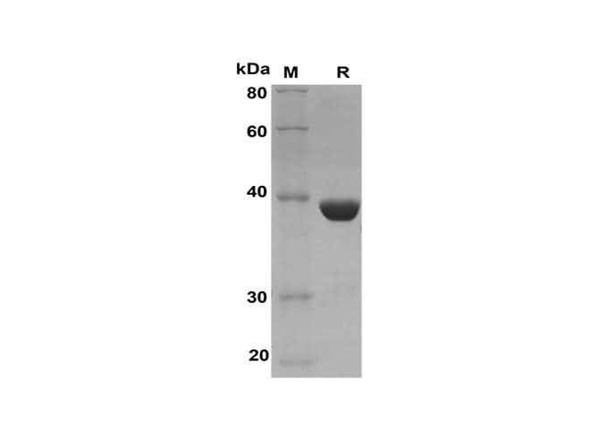 SDS-PAGE analysis of Human GSTAL proteins, 2 μg/lane of Recombinant Human GSTAL proteins was resolved with SDS-PAGE under reducing conditions, showing bands at 39 kDa.
