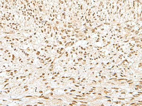 Anti-Human/Mouse/Rat GTF2A2 Antibody