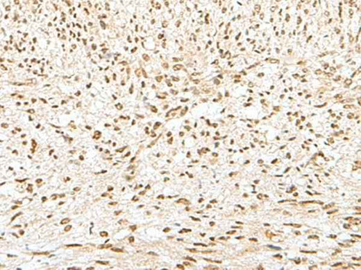 Anti-Human/Mouse/Rat GTF2A2 Antibody