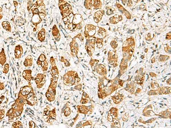 Anti-Human/Mouse/Rat RIMS3 Antibody