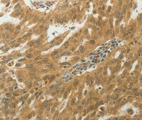 Anti-Human MYSM1 Antibody