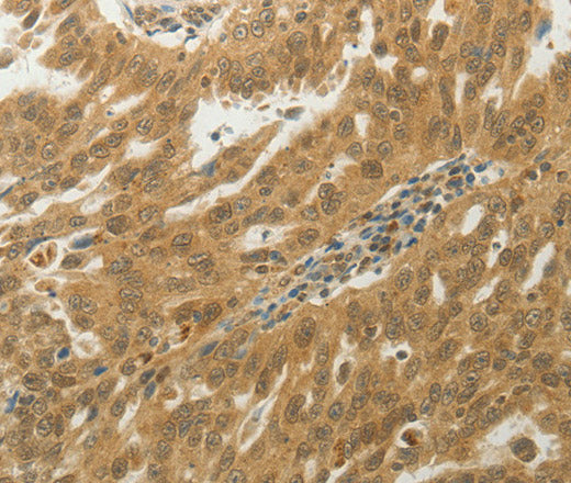 Anti-Human MYSM1 Antibody - ABMIUM