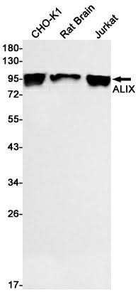 Western blot detection of ALIX in CHO-K1,Rat Brain,Jurkat cell lysates using ALIX Rabbit mAb(1:500 diluted).Predicted band size:96kDa.Observed band size:96kDa.