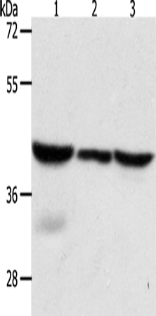 Anti-Human/Mouse/Rat CAPG Antibody - ABMIUM