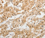 Anti-Human GRIN2C Antibody - ABMIUM