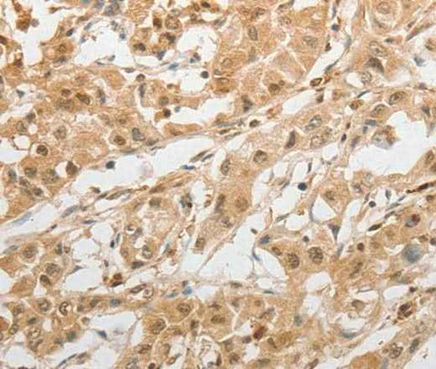 Anti-Human GRIN2C Antibody