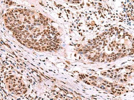Anti-Human/Mouse SF3B3 Antibody