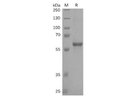 Recombinant SARS-CoV-2 (SARS-CoV-2) S protein RBD (C-mFc-6His tag) - ABMIUM