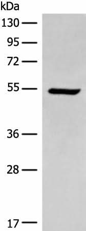 Western blot analysis of HEPG2 cell lysate using ACD Polyclonal Antibody at dilution of 1:400