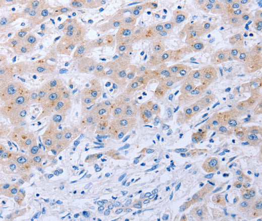 Anti-Human/Mouse FGF4 Antibody - ABMIUM