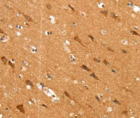 Anti-Human/Mouse SLC25A12 Antibody