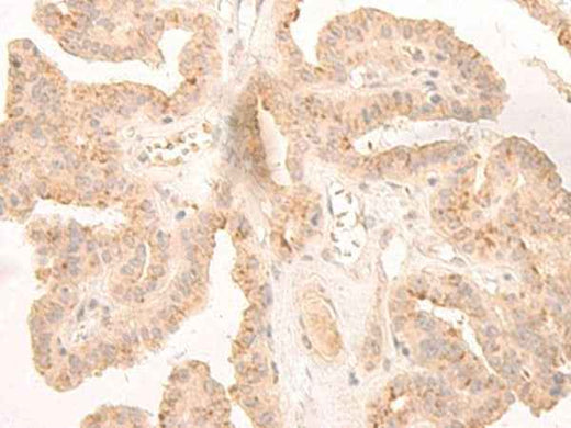 Anti-Human/Mouse/Rat LCMT2 Antibody