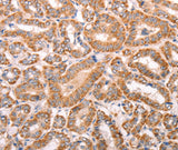 Anti-Human/Mouse/Rat TRPV4 Antibody - ABMIUM