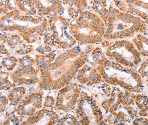 Anti-Human/Mouse/Rat TRPV4 Antibody