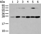 Anti-Human/Mouse/Rat SNAP23 Antibody - ABMIUM