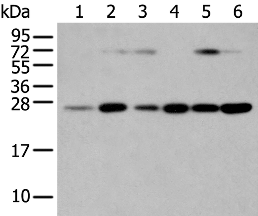 Anti-Human/Mouse/Rat SNAP23 Antibody - ABMIUM