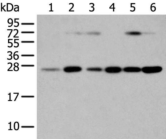 Anti-Human/Mouse/Rat SNAP23 Antibody - ABMIUM