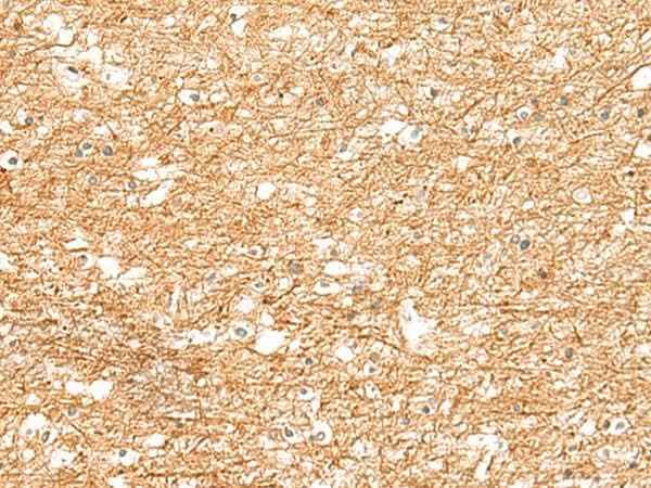 Anti-Human ZNF185 Antibody